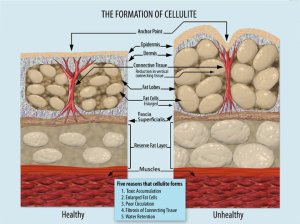 Cellulite structure – click for a close-up! Courtesy of WikiCommons